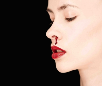 Bloody Nose | The Wellness Directory