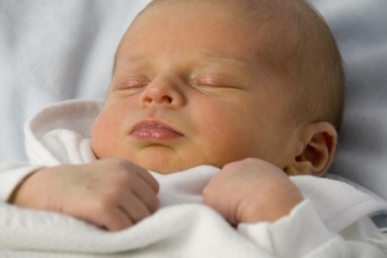 Jaundice | The Wellness Directory